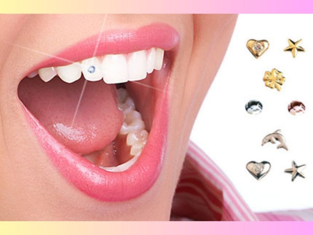 Dental Jewelry Implant